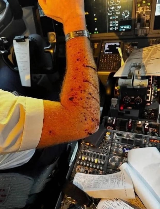 Tech CEO admits responsibility for smashing airplane windshield mid-flight 156165