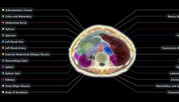 Midjourney is stepping away from AI art to build a full-body ultrasound scanner that it wants to put in spas 2
