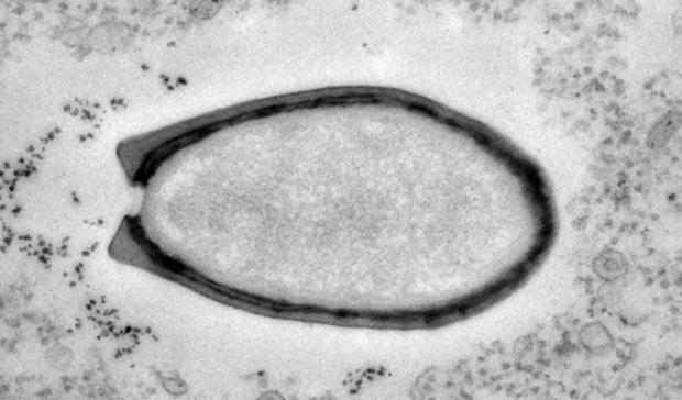 Ancient virus found in Siberia has been brought back to life | TweakTown.com