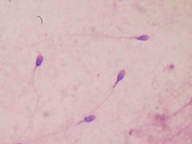 Danish, US donors to the rescue as UK faces sperm shortage | TweakTown.com