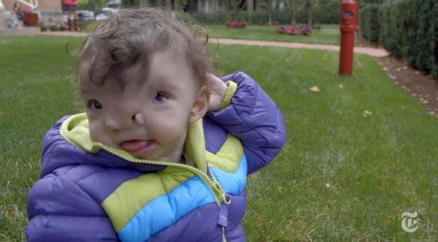 3D printing lets surgeons test practice before giving girl new face | TweakTown.com