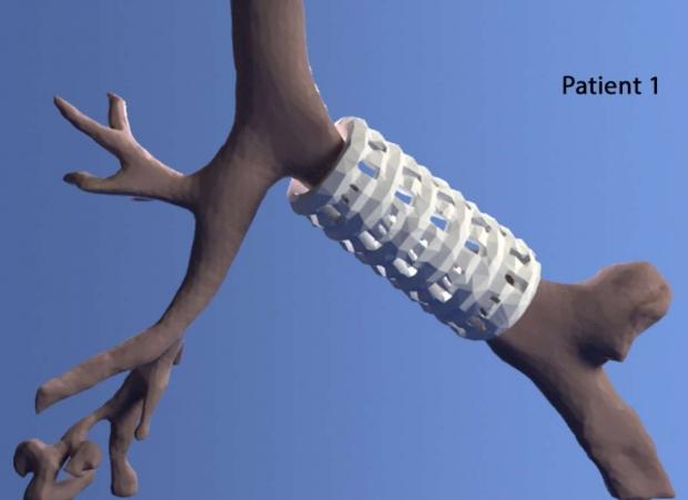 Researchers create 3D printed medical implant that changes shape | TweakTown.com