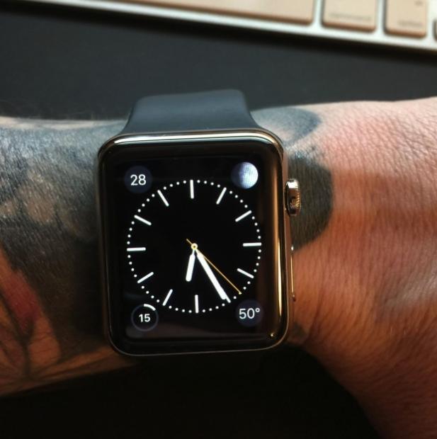 anylist apple watch