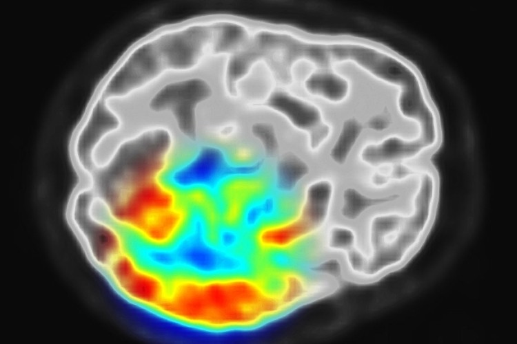 New biometrics uses a 'Brainprint' for identification, 97% accurate