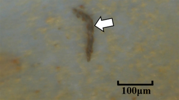 Open enlarged image Small plastic particles now found deep inside human lungs