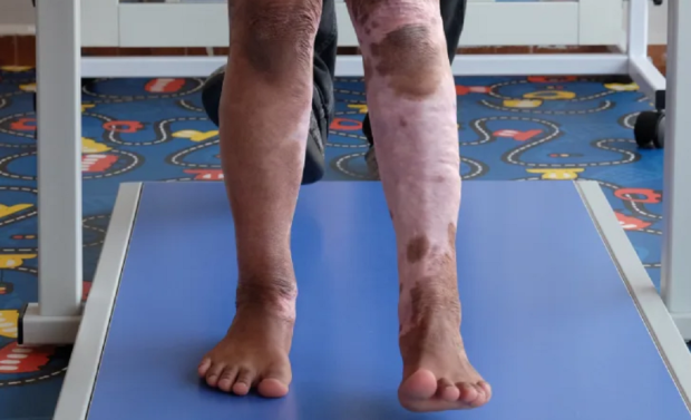 Scientists print edgeless human skin with enhanced biomechanical properties