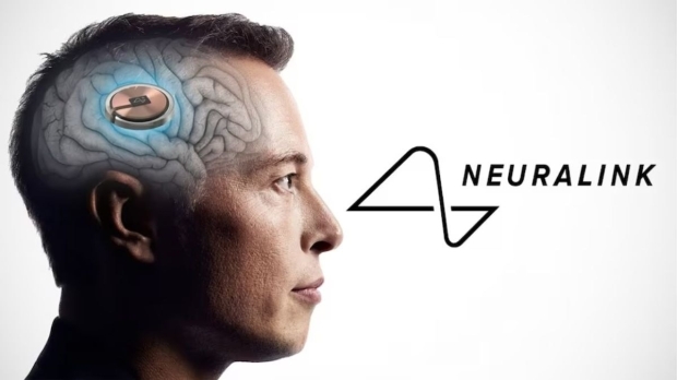 Second Neuralink patient cancelled ahead of brain chip surgery over medical issues 798798